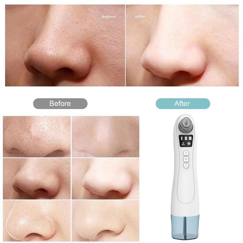Electric Blackhead Suction Instrument Home Beauty Instrument